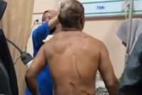Foto: Korban saat ditangani di puskemas. (Istimewa)