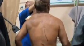 Foto: Korban saat ditangani di puskemas. (Istimewa)