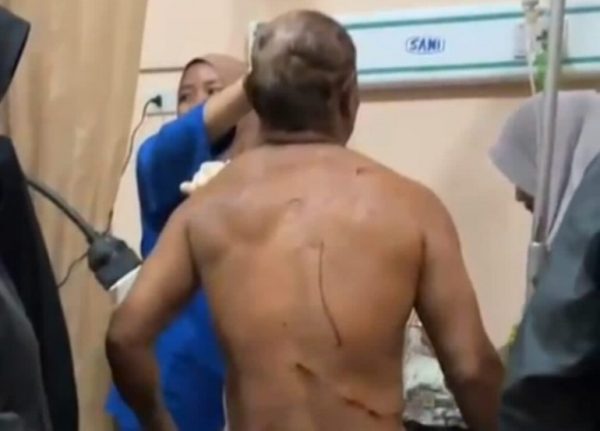 Foto: Korban saat ditangani di puskemas. (Istimewa)